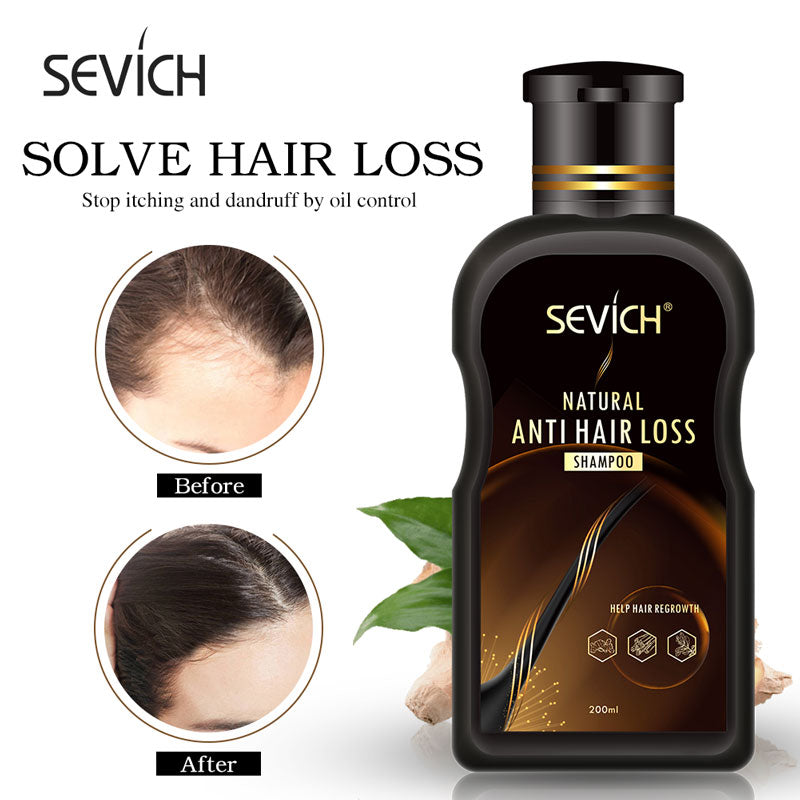 Sevich 200ml Anti Hair Loss Product Hair Loss Shampoo Natural With No Side Effects Grow Hair Faster Regrowth Hair Treatment