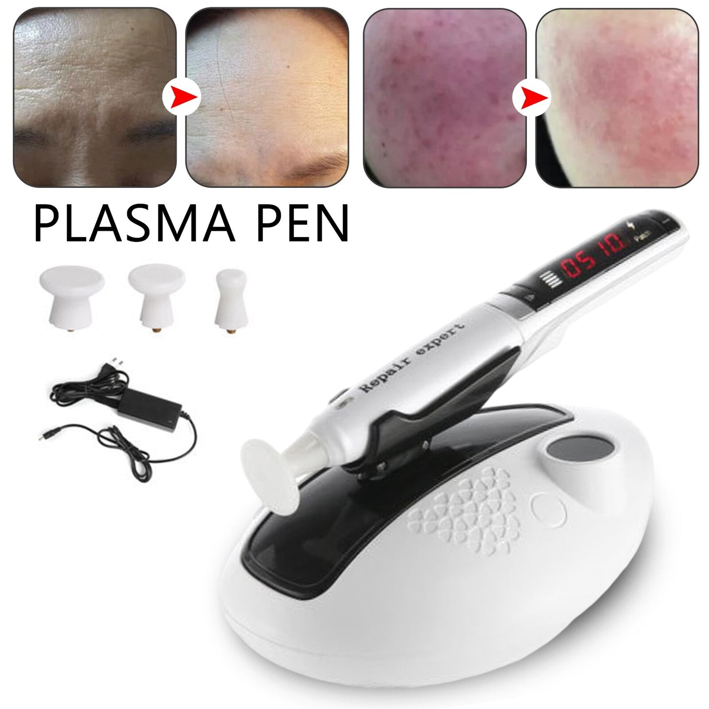 New Ozone Plasma Pen Jet for Skin Rejuvenation &amp; Acne Treatment Removal Skin Care