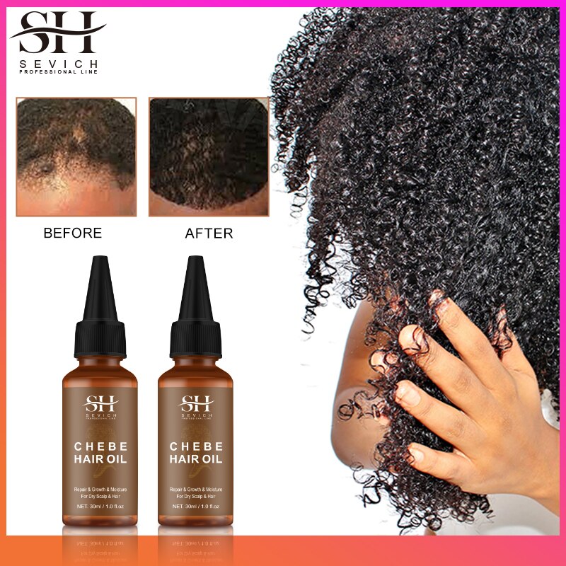 Sevich Africa Traction Alopecia Chebe Hair Thickening Set 30ml Hair Growth Oil Fast Growing 100g Hair Butter Strong  Hair Root