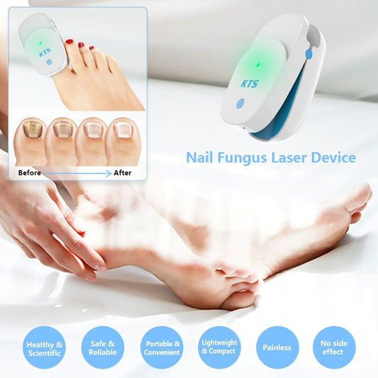 Nail Fungus Laser Treatment 905NM Laser Device 22W Nail Cleaner Therapy Equipment Toe Finger Fungal Remover Onychomycosis